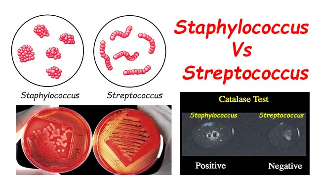 Differences-Between-Staphylococcus-and-Streptococcus.jpg
