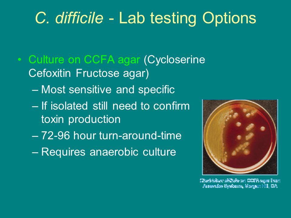 C.+difficile+-+Lab+testing+Options.jpg
