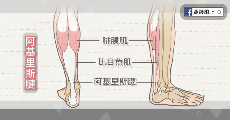 不是跑者也會得到的&ndash; 阿基里斯腱肌腱炎- 照護線上