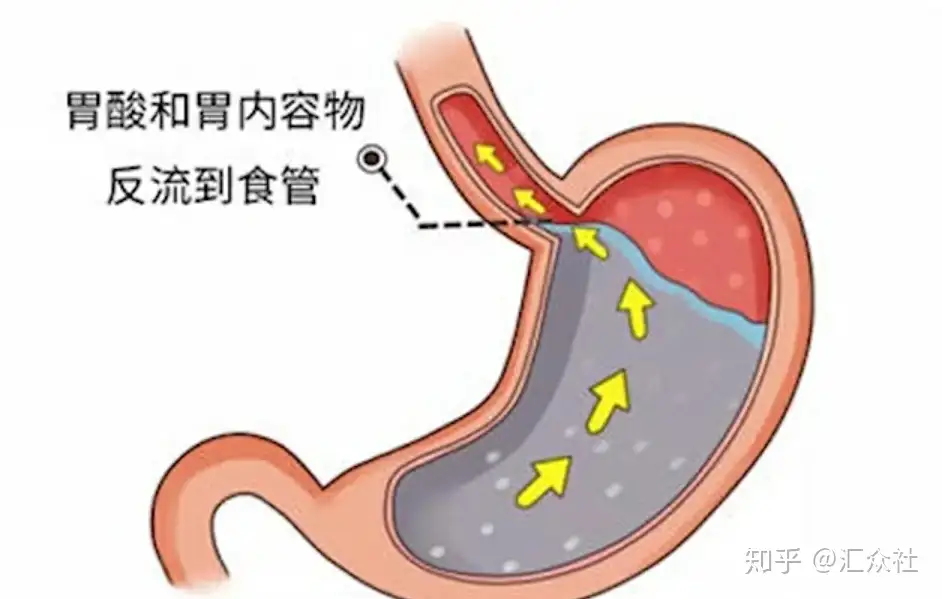 吃完饭就躺下会变胖吗？ - 知乎