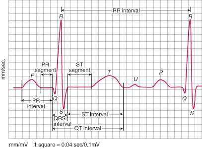 waves-of-the-ecg.png?resize=407%2C300