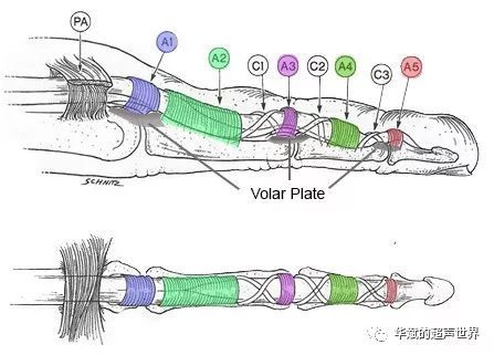屈指肌腱腱鞘炎超声影像的讲解- 大连疼痛科|韩松大夫|痛宁网