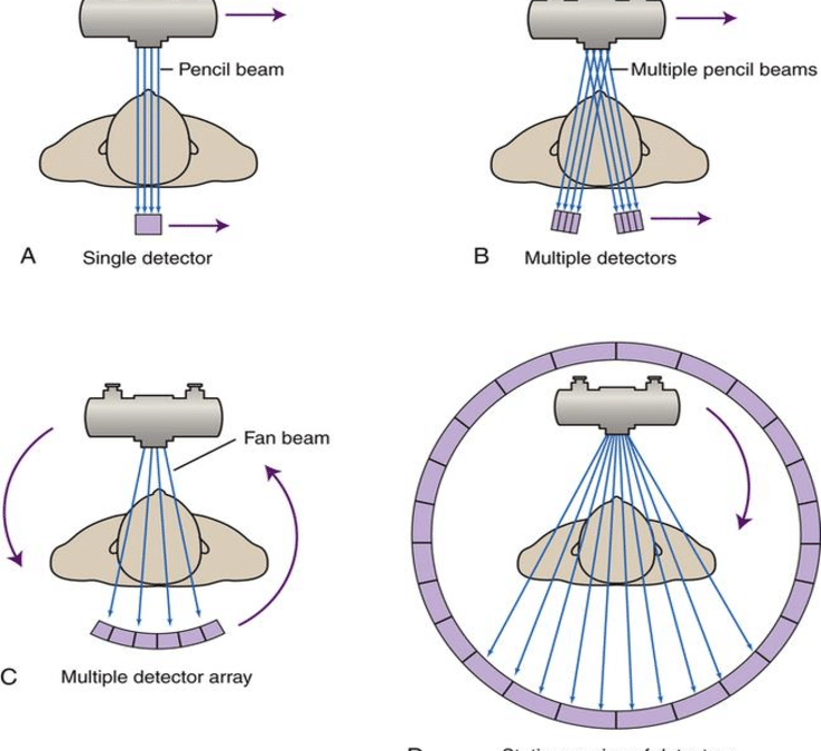 Generations-of-CT-scanners-6-e1688301295569-738x675.png
