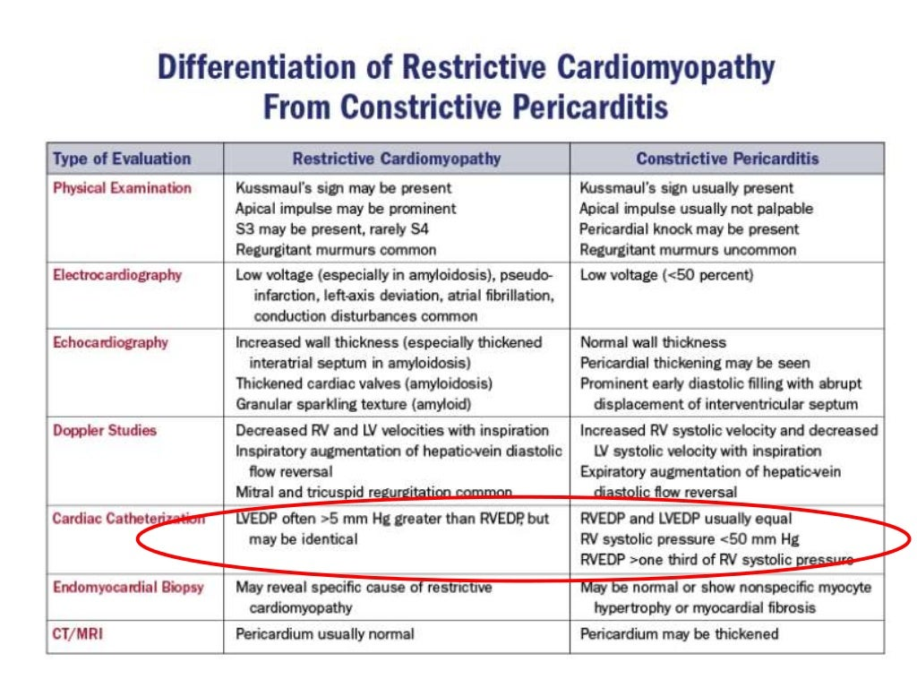 echo-differentiation-of-restrictive-cardiomyopathy-and-constrictive-pericarditis-53-1024.jpg?cb=1485350889