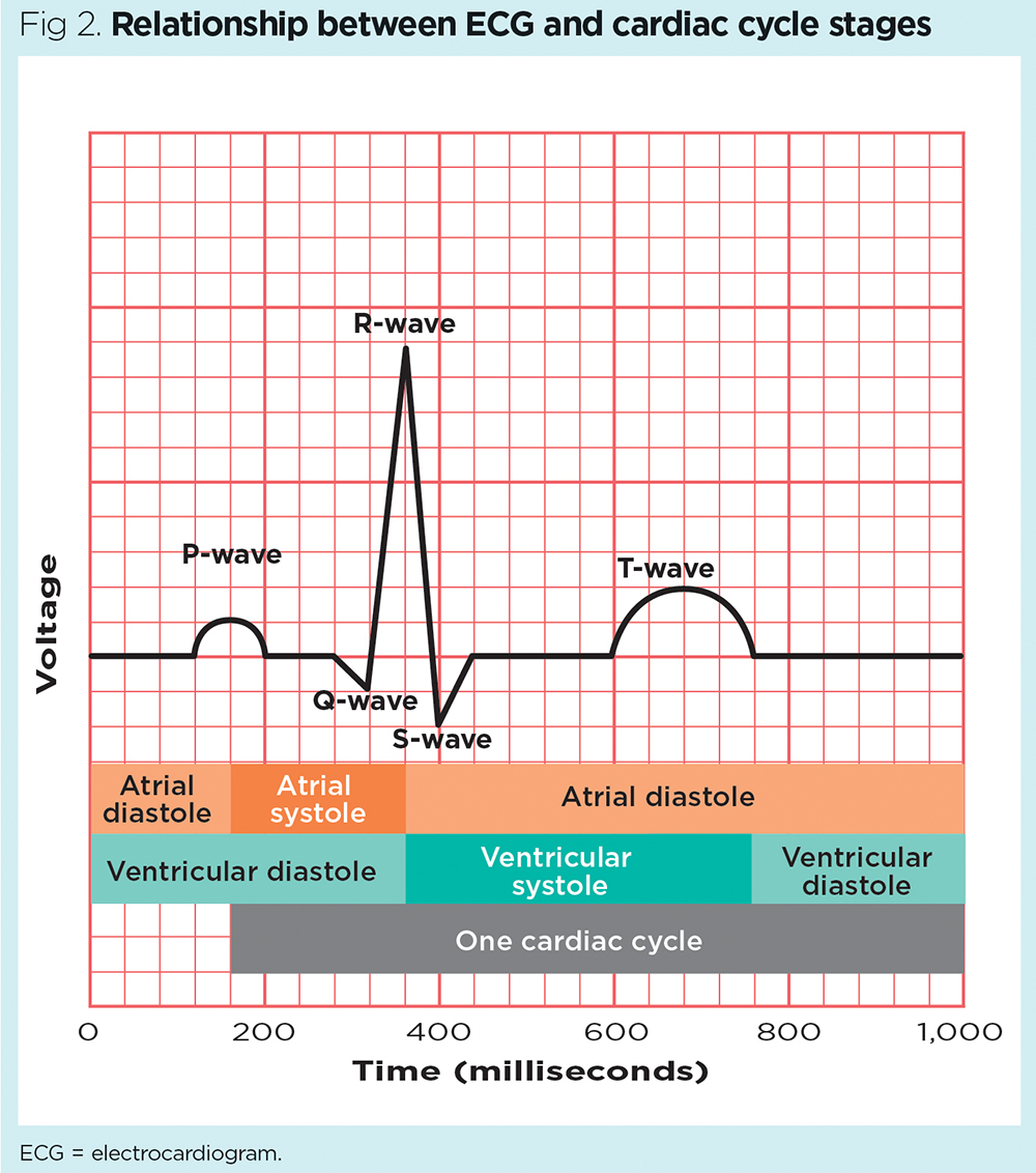 Fig-2-Relationship-between-ECG-and-cardiac-cycle-stages.jpg