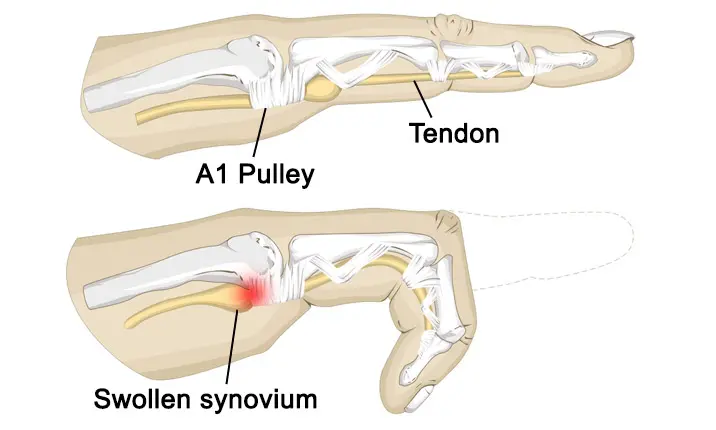 eyJvYXV0aCI6eyJjbGllbnRfaWQiOiJmcm9udGlmeS1leHBsb3JlciJ9LCJwYXRoIjoiaWhoLWhlYWx0aGNhcmUtYmVyaGFkXC9hY2NvdW50c1wvYzNcLzQwMDA2MjRcL3Byb2plY3RzXC8yMDlcL2Fzc2V0c1wvYjBcLzM5OTcxXC9kOTFjZjViMGU0N2E0NGQzNjQ0NDgyMWI3Yjk4YmJiNC0xNjU4MzE5ODk3LmpwZyJ9:ihh-healthcare-berhad:_uL4KviQqYPd24mW8exI2FdlETLopR9W2Z-K8jNawI0?format=webp