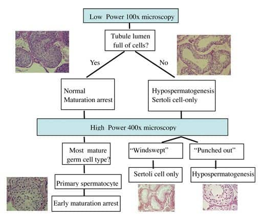 testis-biopsy-reading-chart.jpg