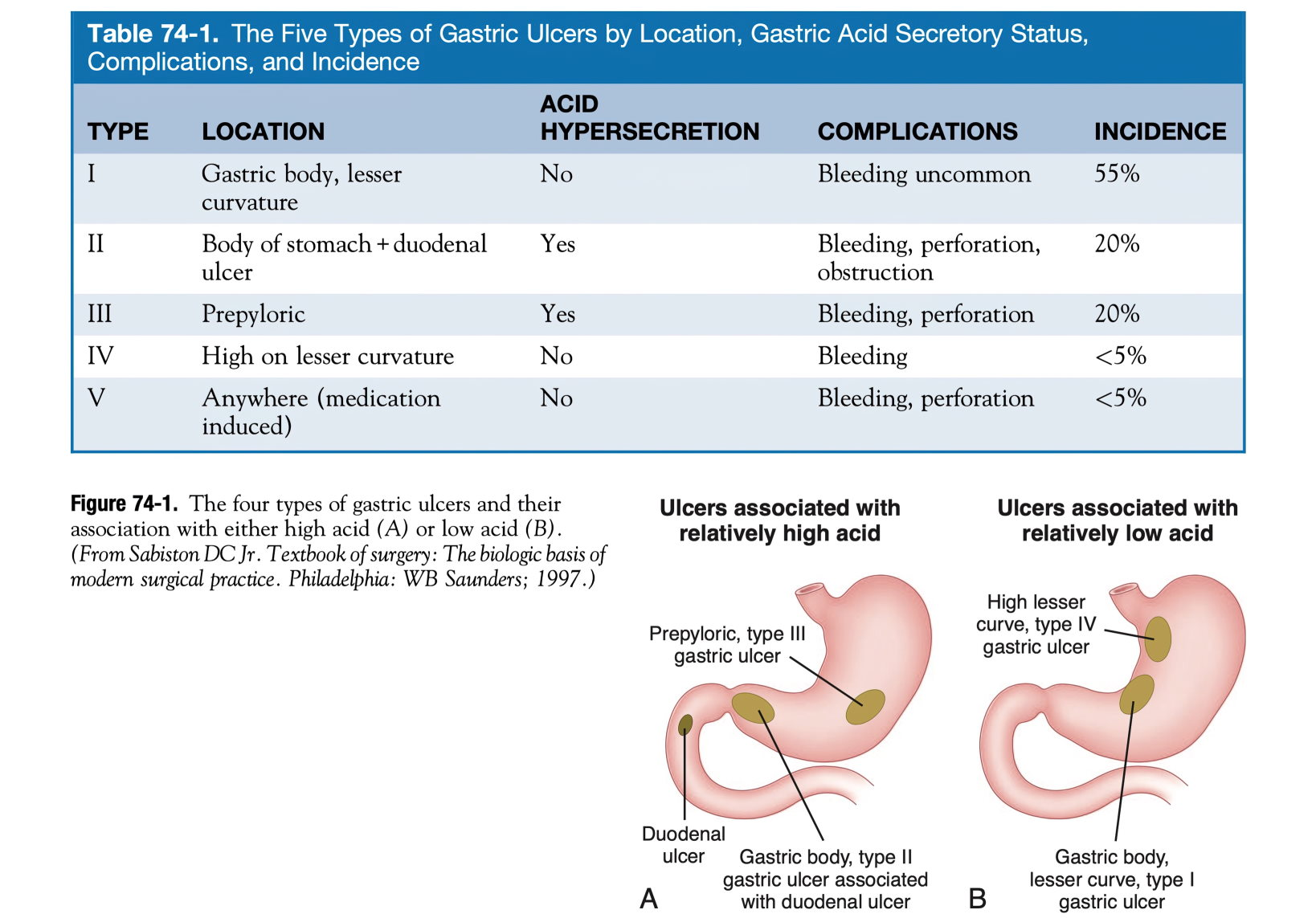 classification-gastric-ulcers-diagnosis-gastroenterology-original.jpeg