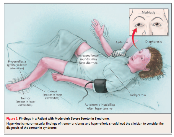 1311735928-aa22c092f02baee10dfe8db506f55