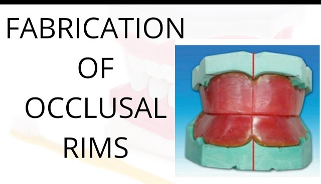 dMczWJE1aI7NWsCgaKzRcQ+LWkmIOpGNHEoKCRVHPrsySwJLAk8Osl8H8GAdZrgTe5GAAAAABJRU5ErkJggg==