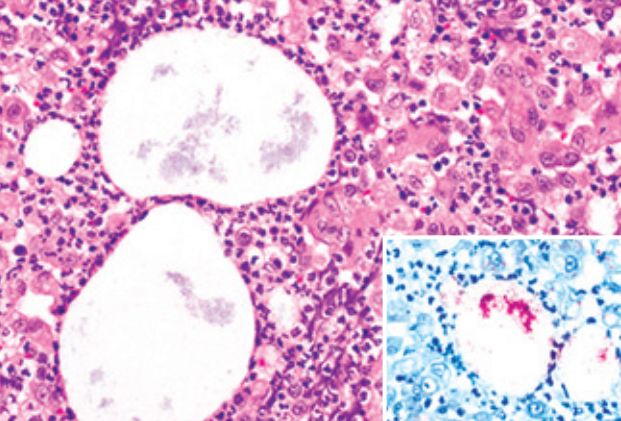 5cf26d2519e0a.jpg#s-621,421