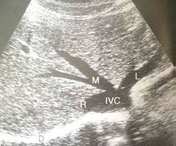 5d145b95326fb.jpg#s-347,287