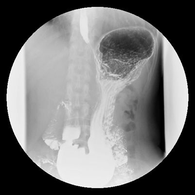 5d15bd71db2a7.jpg#s-401,401