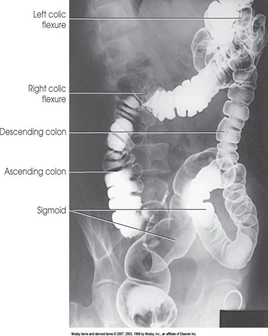 5d15c229c19f4.jpg#s-533,668