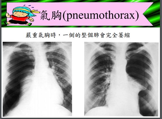 5d1acaf3c0e9a.jpg#s-554,410