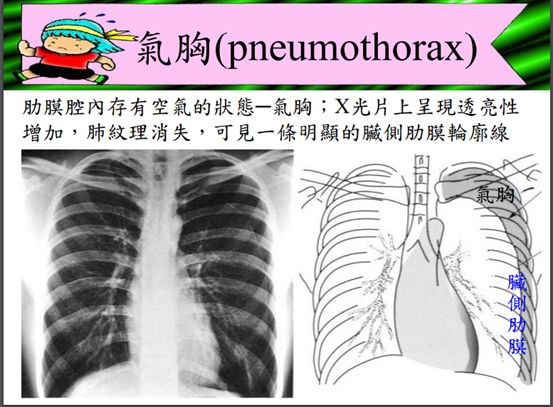 5d1acb0256de9.jpg#s-553,407