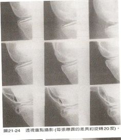 5d1ad171298a7.jpg#s-236,273