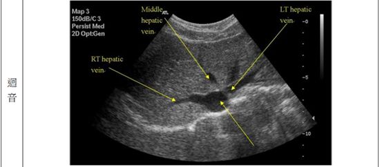 5d1b00024e03b.jpg#s-553,242