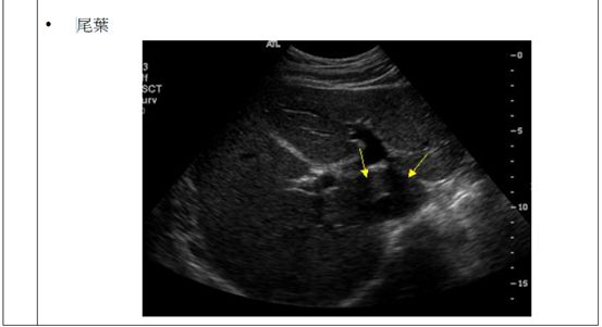 5d1b000ae2839.jpg#s-553,301