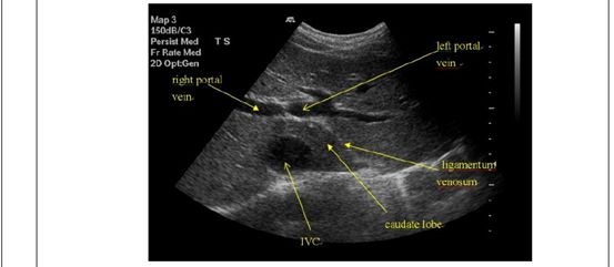 5d1b00144283a.jpg#s-553,241