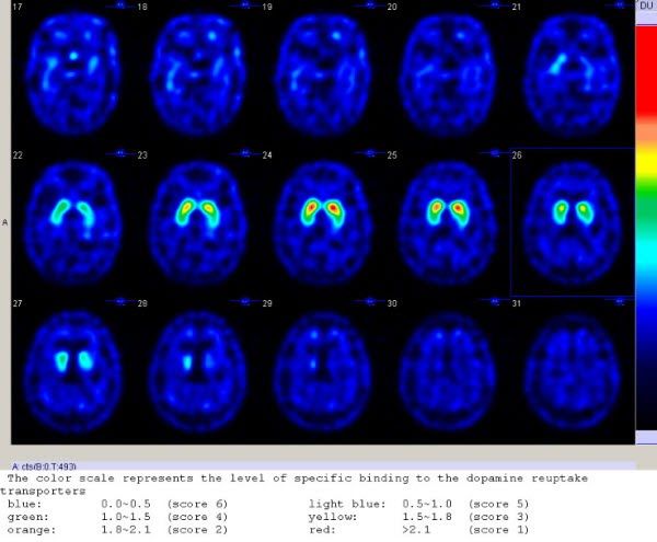 5d1ebdc9005e9.jpg#s-600,495