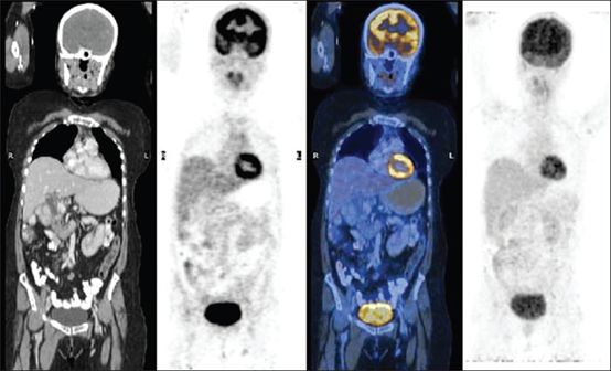 5d1ec99b2a1f7.jpg#s-554,336