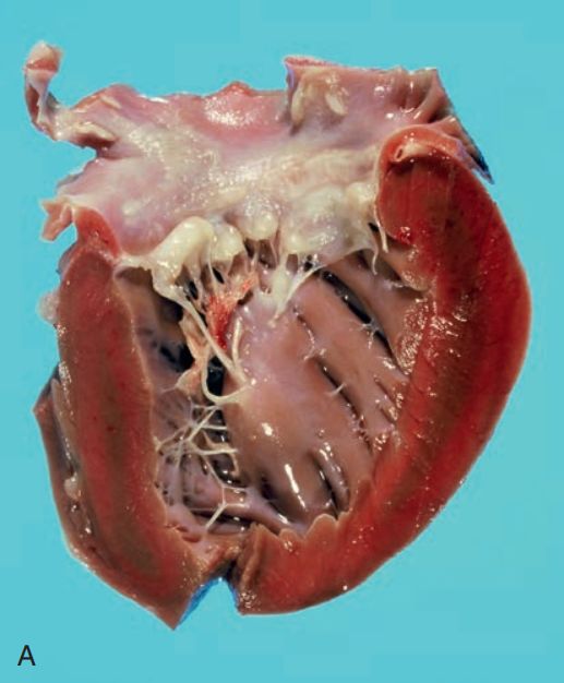 5d1f442bae9e9.jpg#s-517,626