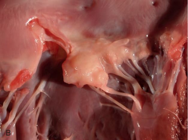 5d1f44463a721.jpg#s-627,468