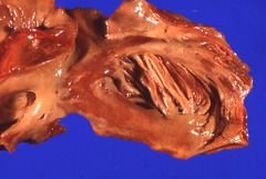 5d20b6d7acc64.jpg#s-240,161