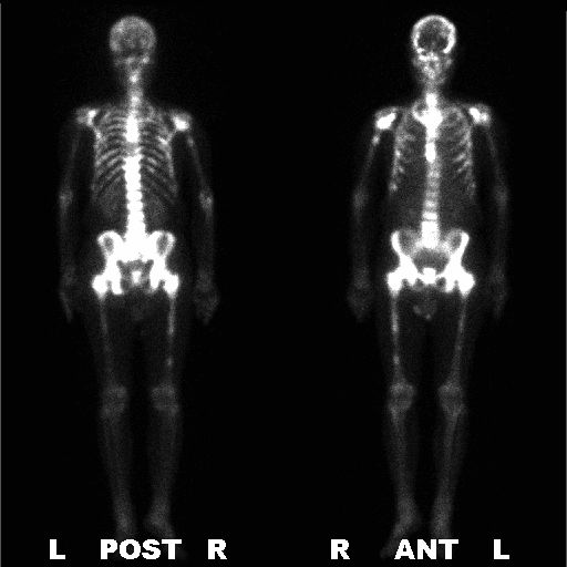 5d20d1c4e762e.jpg#s-512,512