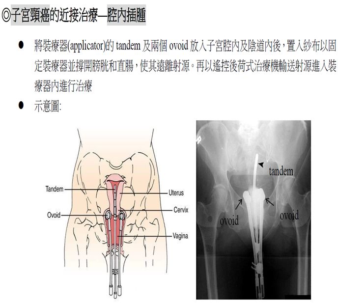 5d20e51e533ff.jpg#s-688,617