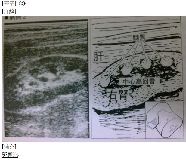 5d22f7444b5ee.jpg#s-618,532