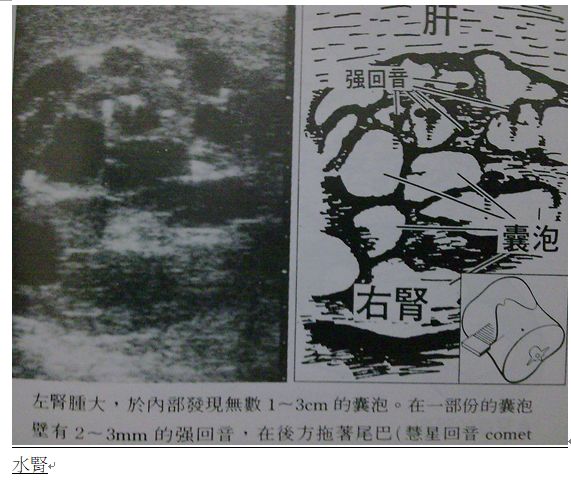 5d22f75e5ab2a.jpg#s-571,480