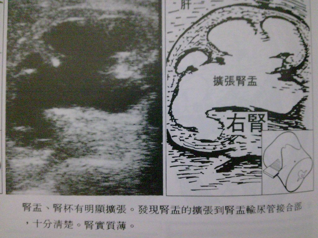 5d22f76c6f0fc.jpg#s-1024,768