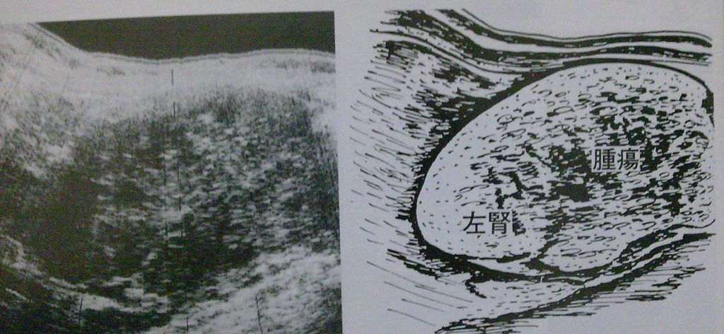 5d22f79c3ddc6.jpg#s-1024,472