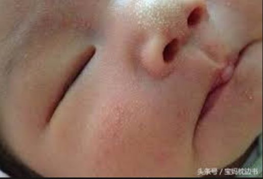 5d381a6d16547.jpg#s-515,352