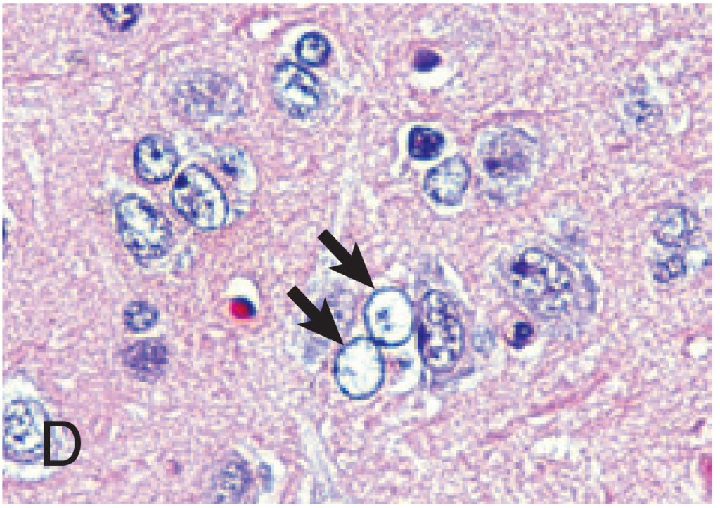 5e30499d8976a.jpg#s-1024,723