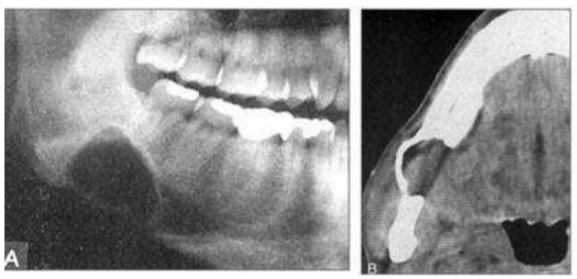 109 年 109 1 專技高考 牙醫師 二 牙醫學 四 包括口腔顎面外科學 牙科放射線學等科目及其相關臨床實例與醫學倫理 787 阿摩線上測驗