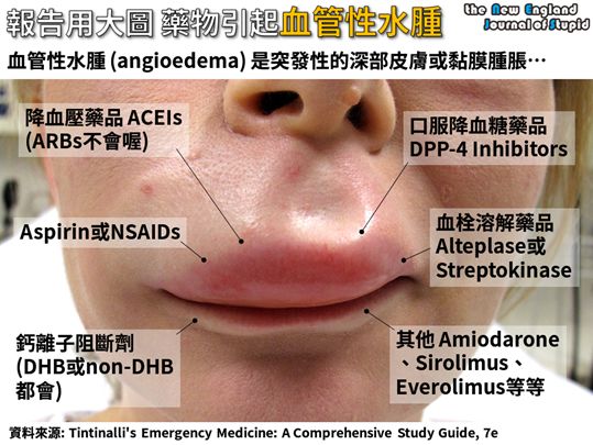 5ea060257b0bf.jpg#s-539,405