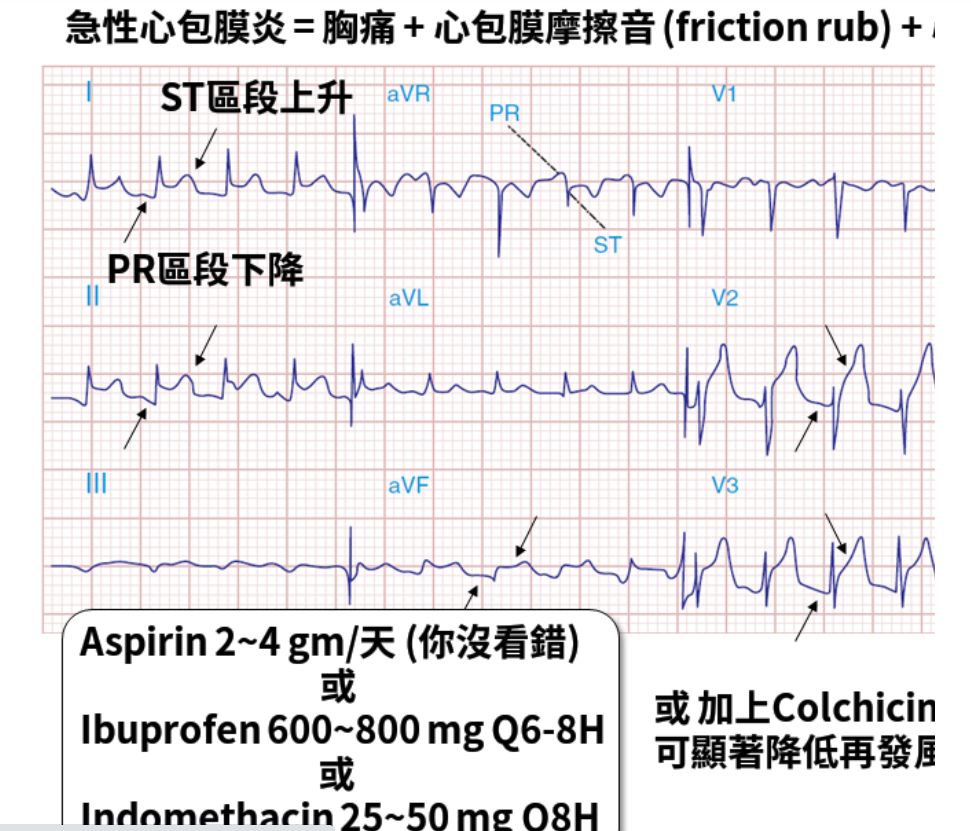 5f582ed26a2fb.jpg#s-971,831