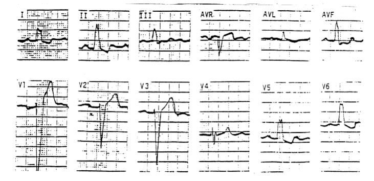 ox+02xUe2wAAAABJRU5ErkJggg==