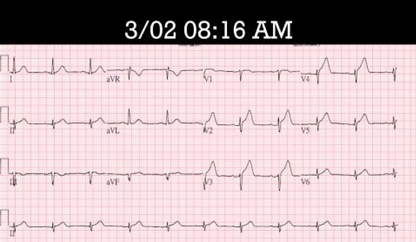 AFa5JfCCpoqHAAAAAElFTkSuQmCC