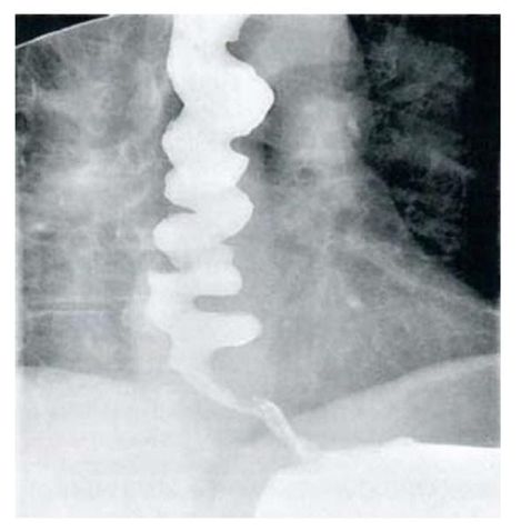 AY9KAQ0xRcs7AAAAAElFTkSuQmCC