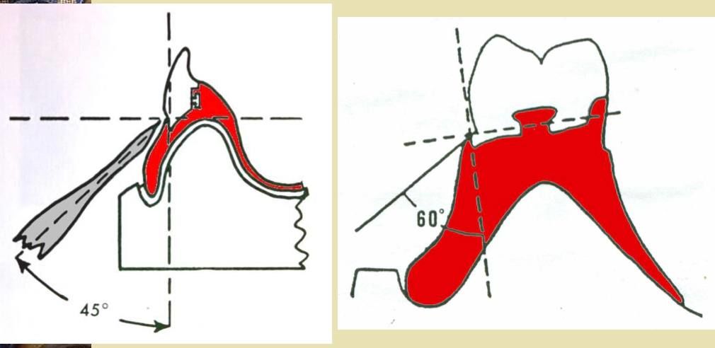 62af1ae08315f.jpg#s-1010,492