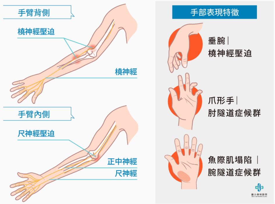 6a325a43100a6.jpg