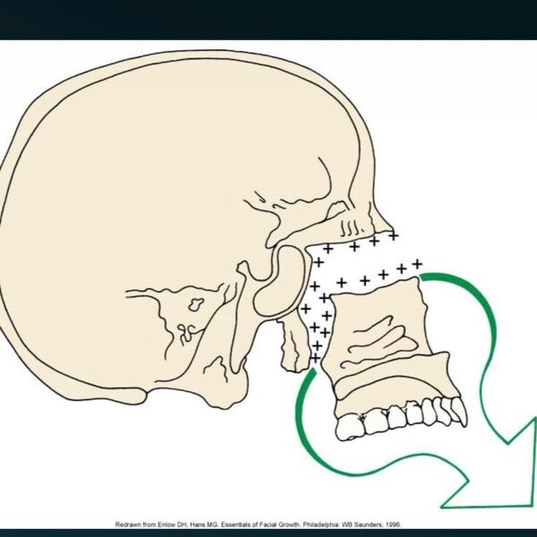 6a32a79b1cdf5.jpg