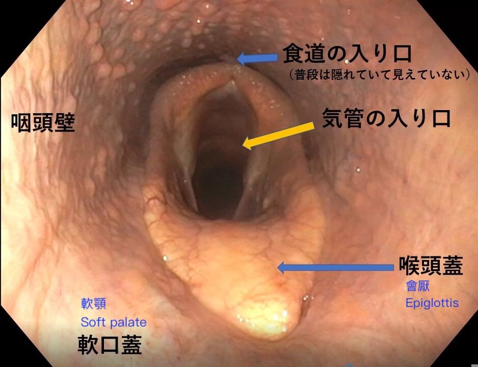 6a44ca3089831.jpg