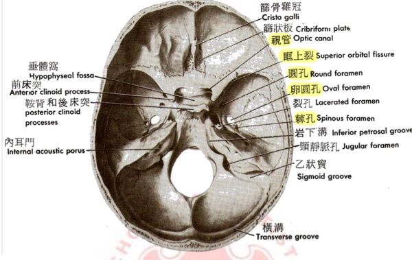 6a4773cce64fc.jpg