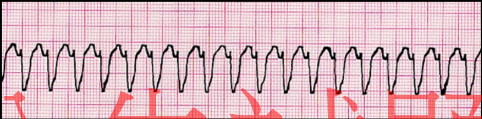 phpjrkV2v