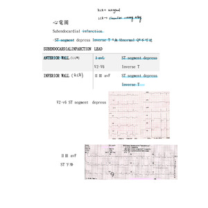 心電圖all